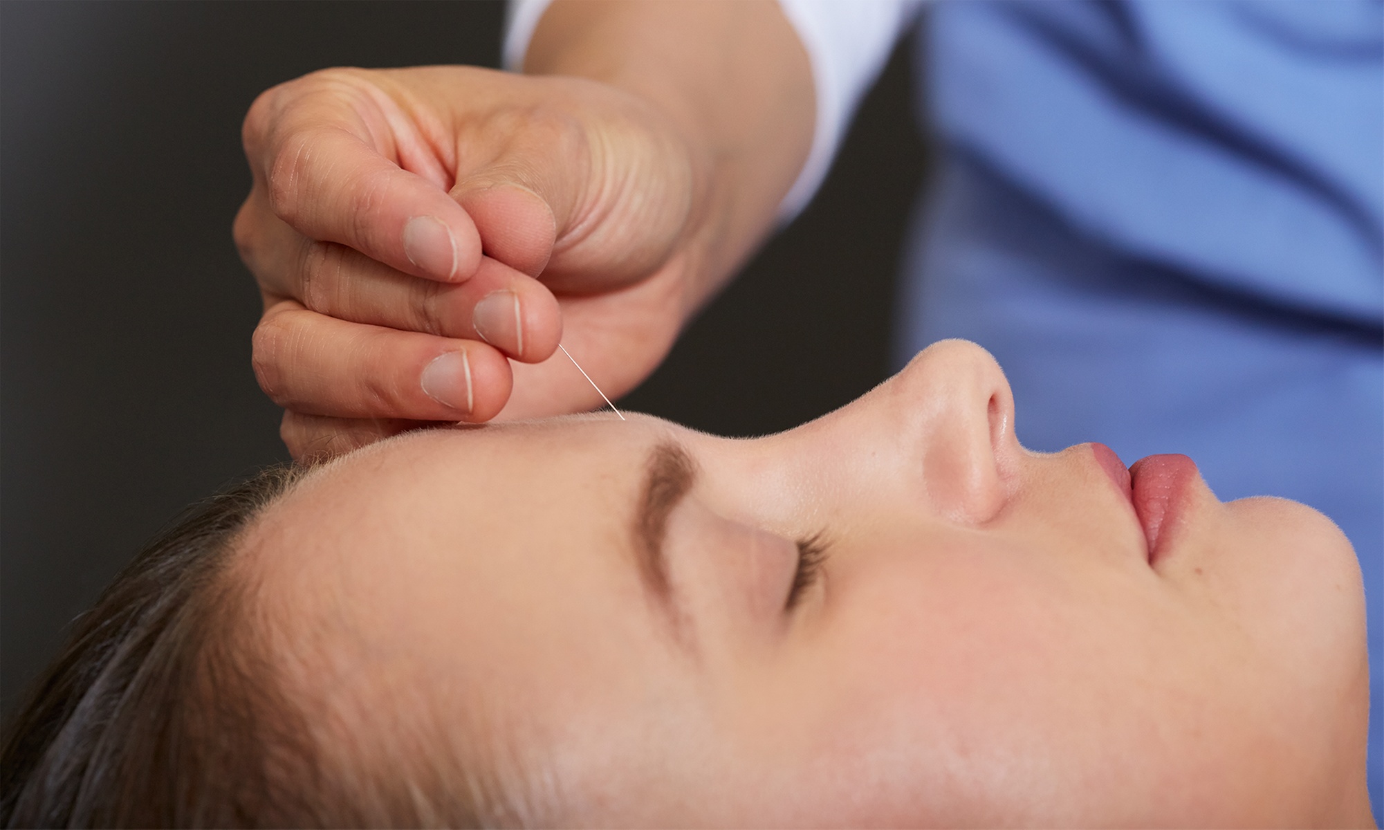 Experience Holistic Healing with 60-Minute Acupuncture Treatments