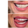 Image 6: Achieve a Radiant Smile with In-Office Whitening/Cleaning Options