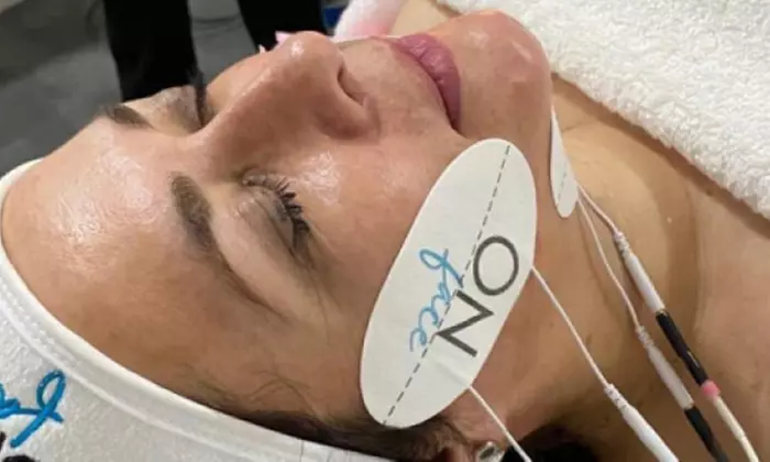 1 o 2 sesiones de lifting facial sin cirugía y opción a higiene facial