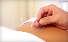 Up to 78% Off Acupuncture Treatments with Consultation