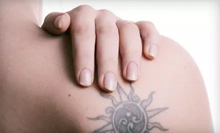 Tattoo Removal at Berkshire Cosmetic and Reconstructive Surgery Center in Pittsfield (Up to 65% Off). Three Options Available. - Primary Image
