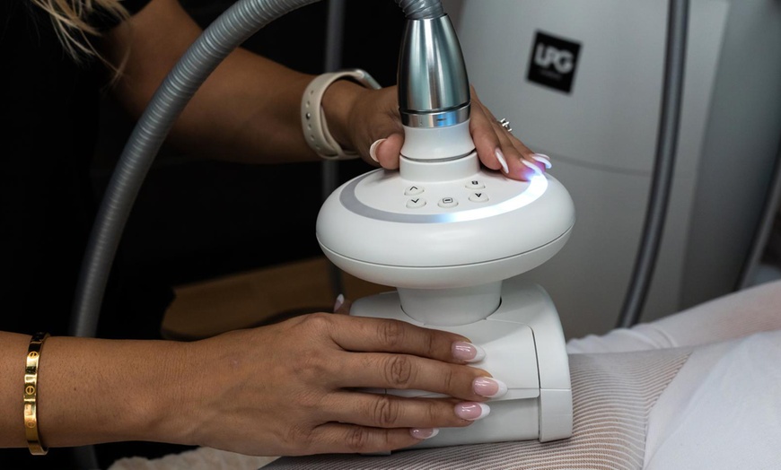 Image 6: 1, 2 o 5 sesiones de Indiba facial efecto rejuvenecimiento para 1 