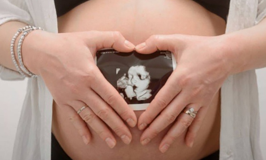Image 6: Up to 37% Off on Ultrasound - 3D / 4D at Miracle Ultrasound And Spa Llc