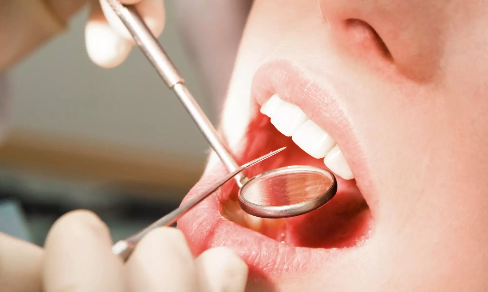 Dental Exam, Cleaning, and X-rays at Smile Design Associates (Up to 82% Off)   - Primary Image