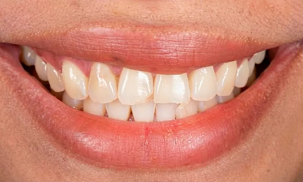 Comprehensive One Dental Exam, Cleaning, and Set of X-Rays