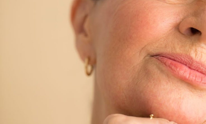 Image 10: Plump, Smooth & Glow: 0.5, 1 or 2 ml Dermal Filler with Consultation