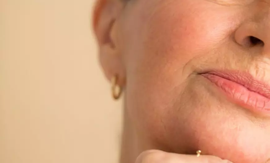 Image 10: Plump, Smooth & Glow: 0.5, 1 or 2 ml Dermal Filler with Consultation