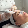 Image 4: Full Face, Neck Skin Needling Session Treatment at TEAMO&T