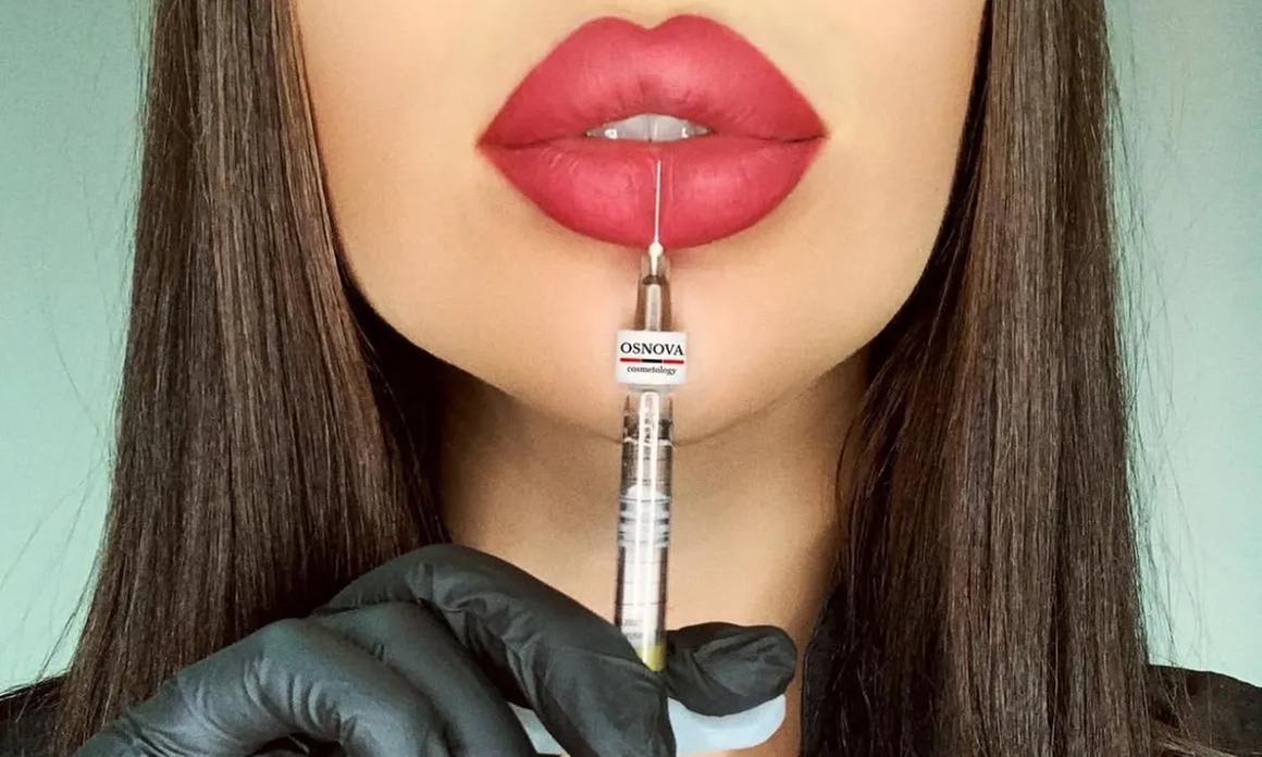 Up to 43% Off on Injection - Dermal Filler at Lotus Clinic