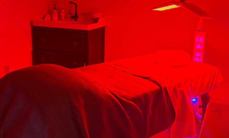 Image 2: Feel Relaxed with a Single Acupuncture Session