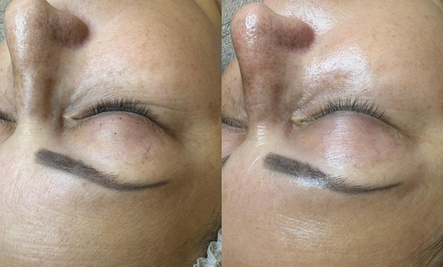 Image 6: Deep Cleansing Facial with Optional Choice of Add-on Treatments