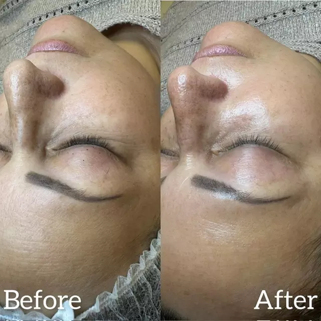 Deep Cleansing Facial with Optional Choice of Add-on Treatments