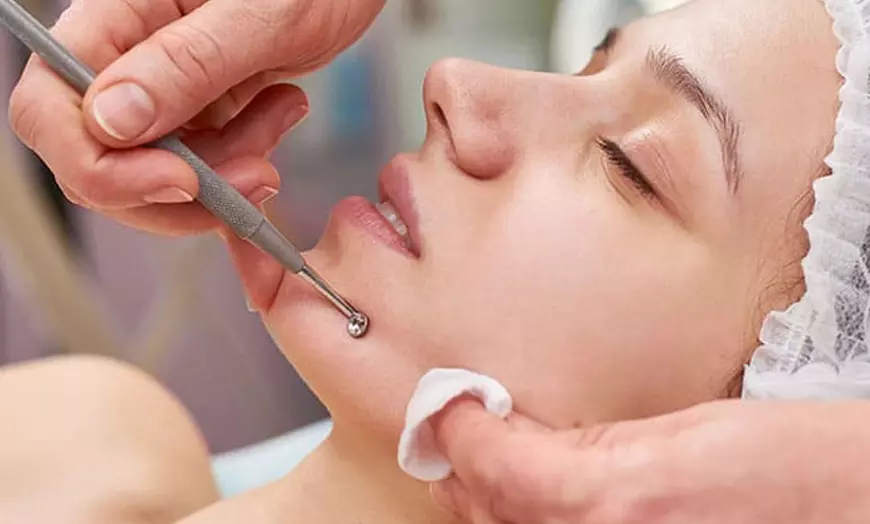 Image 4: Limpieza facial profunda y opción a radiofrecuencia, vitamina C y más