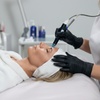 Image 1: Aqua Facial und/oder Microneedling für 1 Person