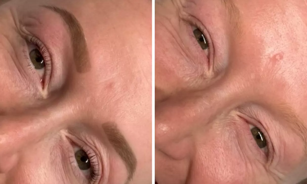 Transform Your Look with a Full Set of Eyelash Extensions