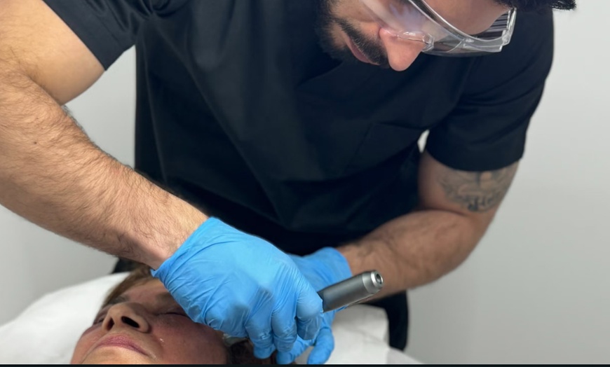 Image 7: 1 o 3 sesiones de rejuvenecimiento facial con láser ‎revitalizante