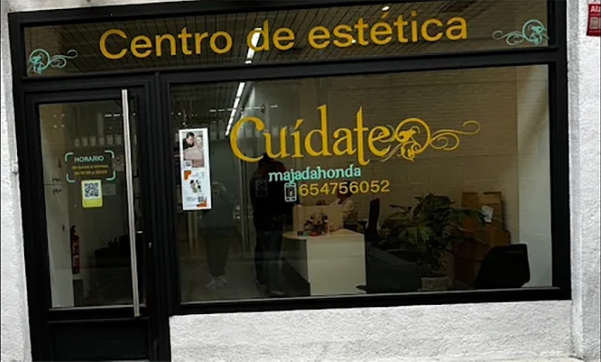 Image 4: Microdermoabrasión con punta de diamante en Cuídate Majadahonda