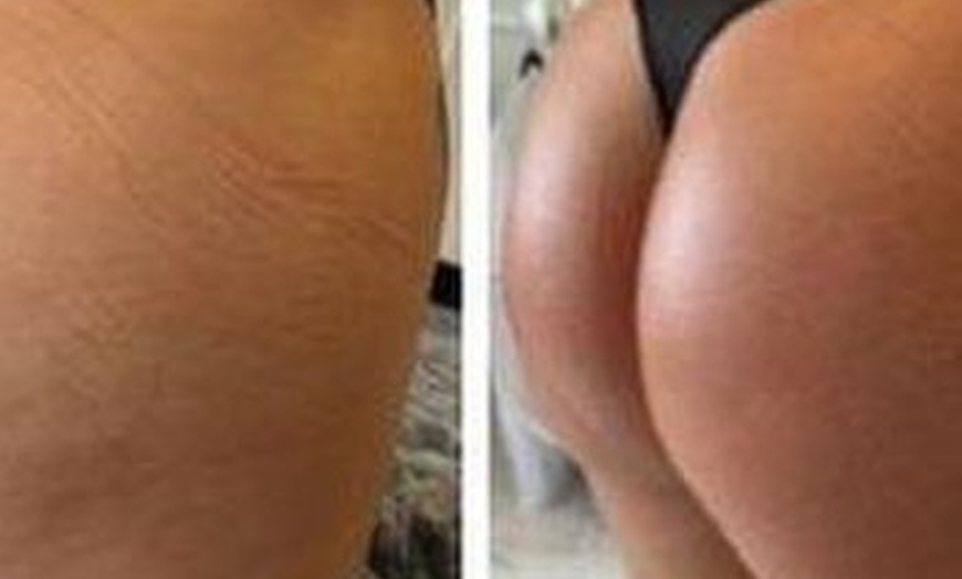 Image 6: Track Progress with 3D Body Scans and Body Sculpting Sessions