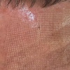 Image 4: 1 o 3 sesiones de rejuvenecimiento facial con láser ‎revitalizante