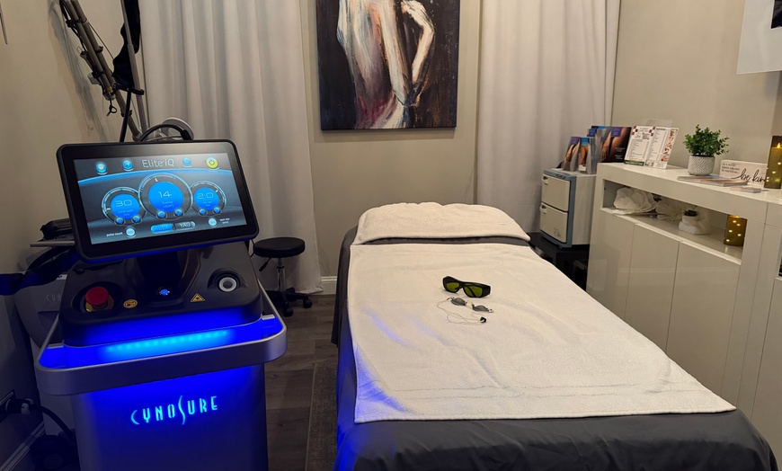 Image 3: Spider Vein Removal for a 2x2 / 4x4 Area Or Full Leg Treatment