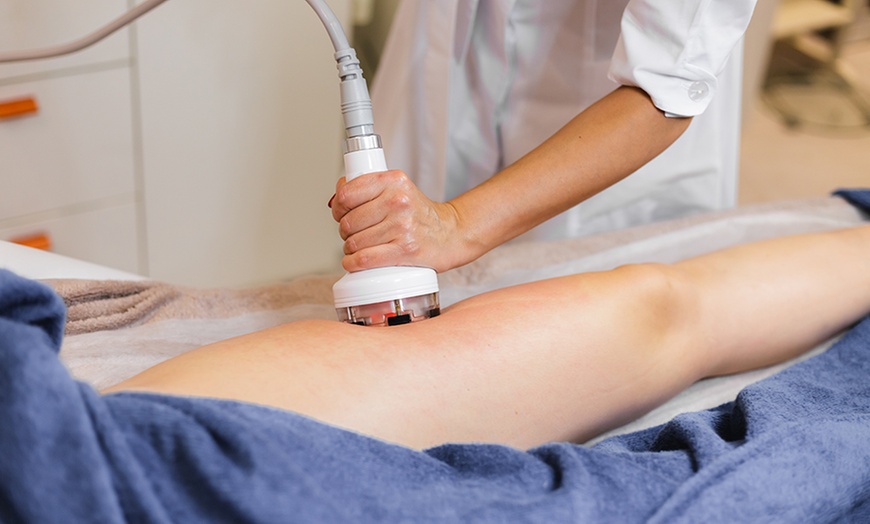 Image 3: 2, 4 o 6 sesiones de cavitación, presoterapia y radiofrecuencia 