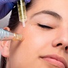 Image 3: 1 o 2 sesiones de microlifting facial con vitaminas con Dermapen
