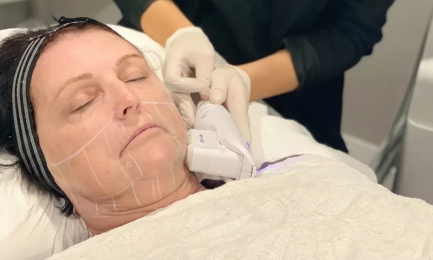 Image 2: Achieve Smoother Skin with Non-Surgical HIFU Face & Body Treatments