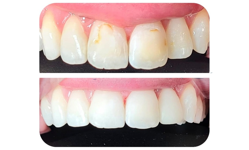 Image 5: One 30-Minute Hygienist Appointment at Dental Studios