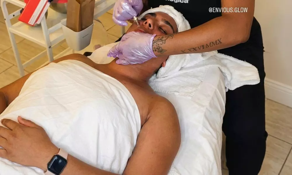 Rejuvenate with a 60-Min Microdermabrasion Facial