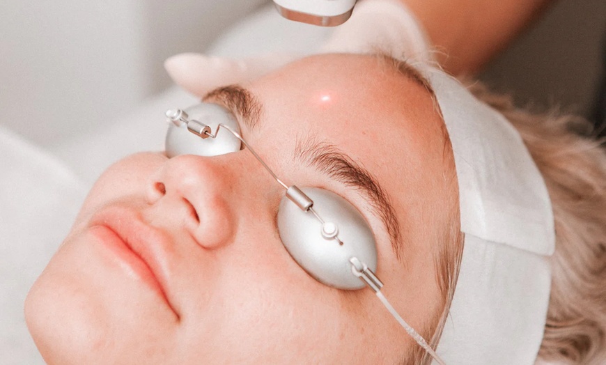 Image 3: Refresh Your Skin with Two or Three Laser Genesis Treatments