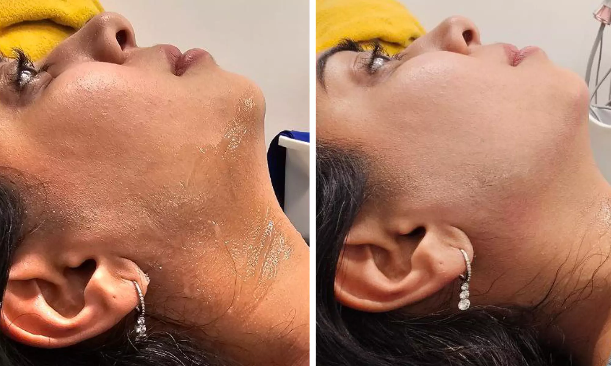 Enjoy Pressotherapy Lymphatic Massage, RF Tightening, or Cavitation!