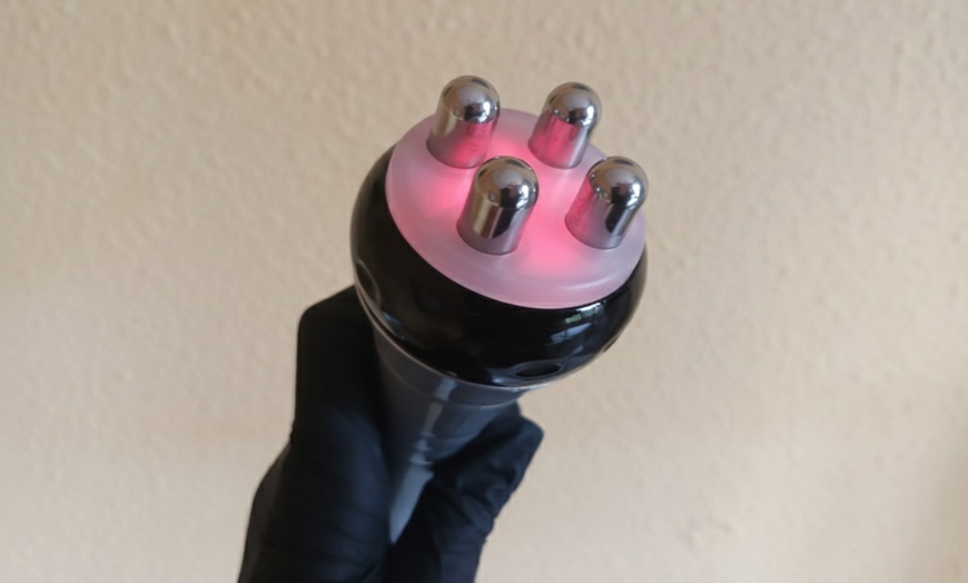 Image 3: Limpieza facial con radiofrecuencia, microdermoabrasión y mascarilla 