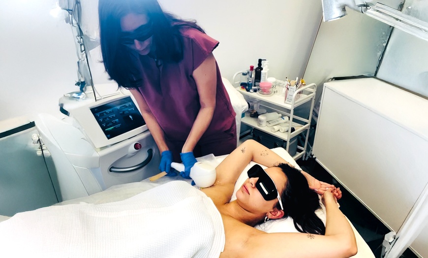 Image 1: Up to 82% Off on Laser Hair Removal at Silhouette Aesthetic