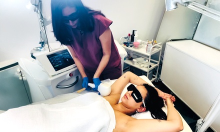 3 Laser Hair Removal Sessions on One Small Area - Silhouette Aesthetic