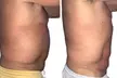 Transform Your Body with T-Shape 2 Body Contouring Intro Session at Blessed Beauty Boutique (Up to 56% Off) - Second Medium