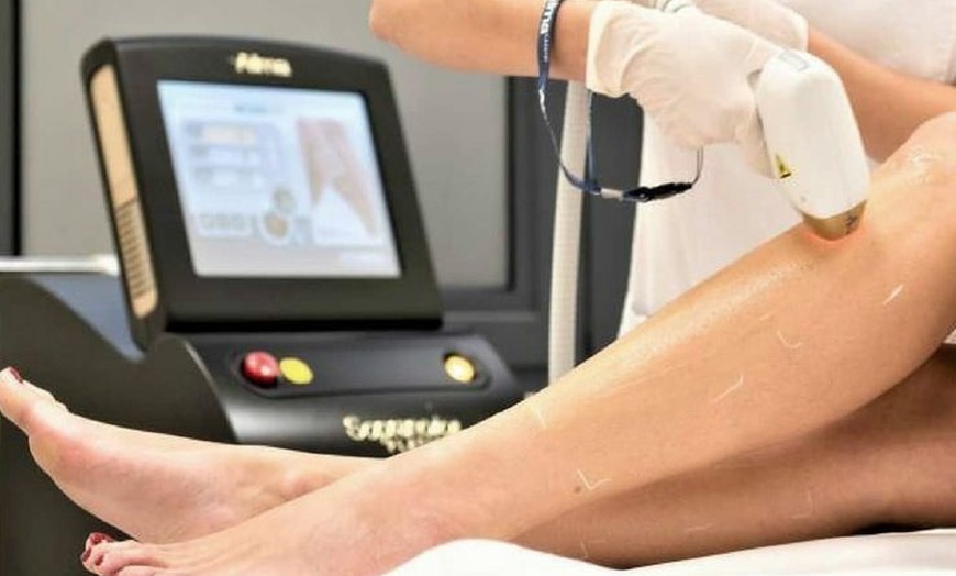 Image 3: 6 Premium Laser Hair Removal Treatments at Lux Clinic in London