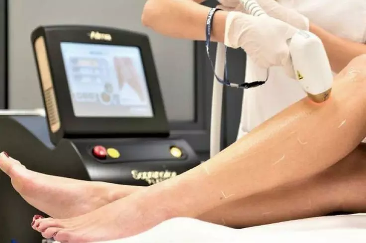 6 Premium Laser Hair Removal Treatments at Lux Clinic in London