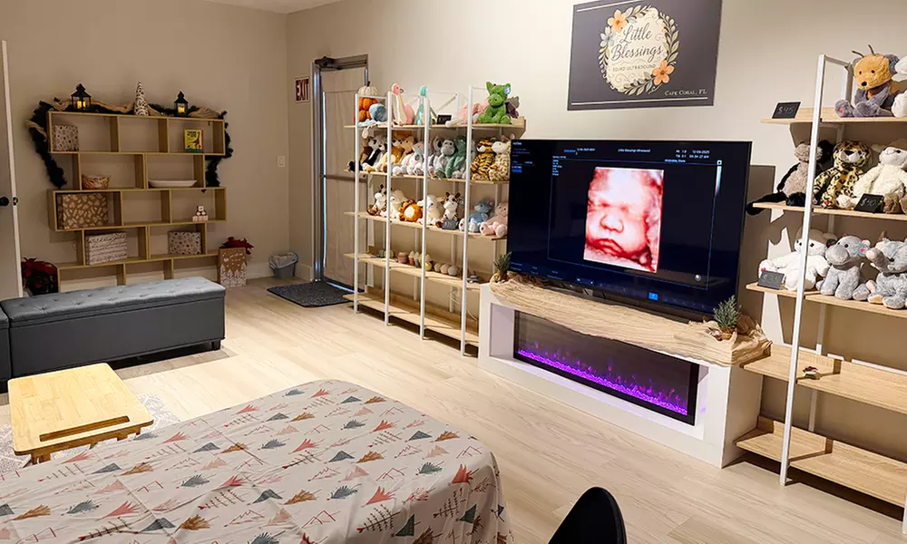 Little Blessings 3D/4D Ultrasound Offers Advanced 2D, 3D, or 4D Ultrasounds for Precious Memories(Up to 40% Off) - Primary Image