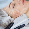 Image 1: Up to 30% Off on IPL Photo Facial at Prolase Medispa