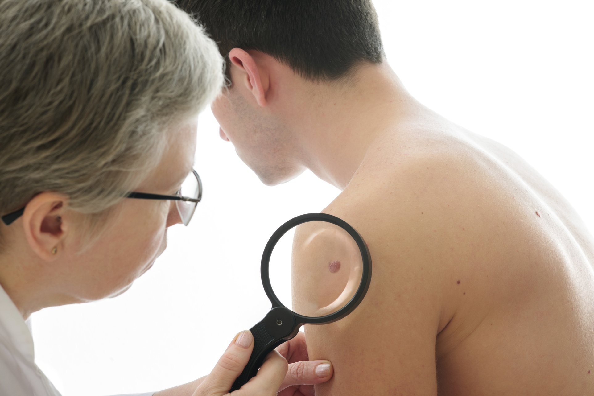 Remove Skin Tags, Moles, and More with Ease and Precision