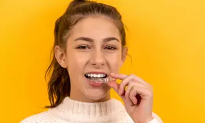 ✨ Full Dental Consultation for Implants, Aligners, or Bonding at Euro Dental Care, Harborne ✨ (Up to 67% Off)