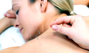 Acupuncture Sessions