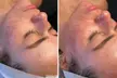 Reveal Glowing Skin with One or Two VI Peel at River Oaks Galleria Medspa (upto 54% Off) - Second Medium