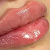 Image 5: Smooth, Plump & Perfect: Versa Enhancements at Divaa Beauty