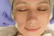 Revitalize Your Skin: One or Three Light or Deep Chemical Peels at Health Link Medical Group ( Up to 65% Off ) - Second Medium