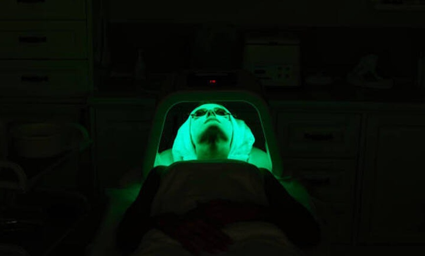 Image 3: 1 o 2 sesiones de peeling rejuvenecedor de vitamina C 