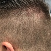 Image 3: Buzz or Scissor & Clipper Cut for Adults – Clean, Easy Style
