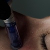 Image 2: One or Three Sessions Micro-needling w/ Glow Skin Booster (PDRN-Based)