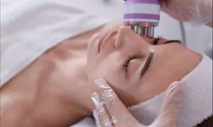¡Hasta 57% de descuento en higiene facial con peeling iónico y radiofrecuencia! ¡No te lo pierdas!