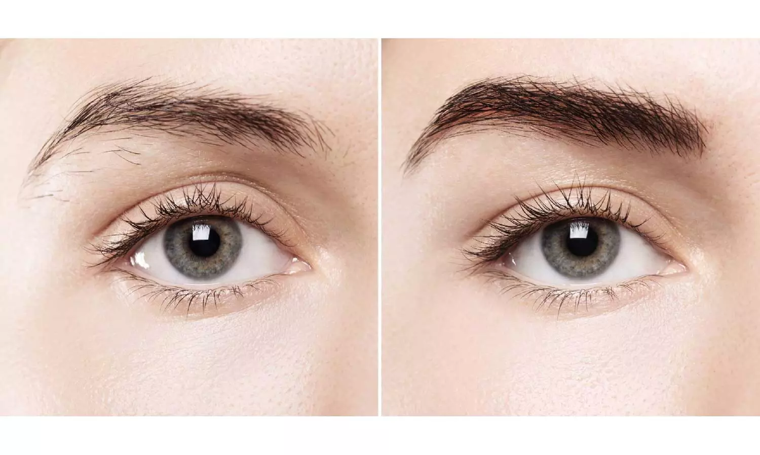 The Magic at Victoria Med Spa With Eyebrow or 3D Microblading Session 
